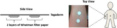 Research on sweat metabolomics of athlete’s fatigue induced by high intensity interval training